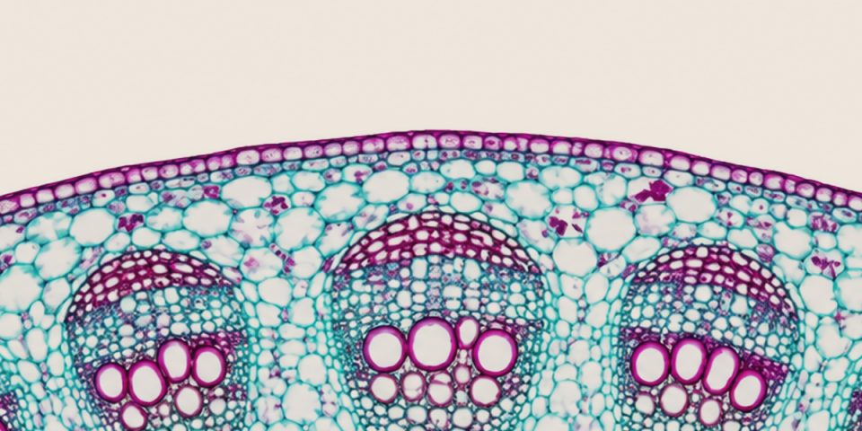 Stained plant stem cross-section, magenta and teal cells